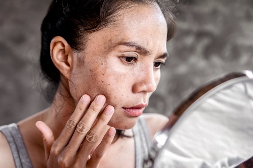 skin disease ayurveda skin disease ayurveda
