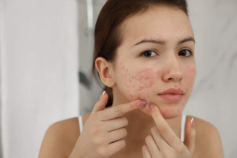 ayurvedic medicine for skin diseases ayurvedic medicine for skin diseases