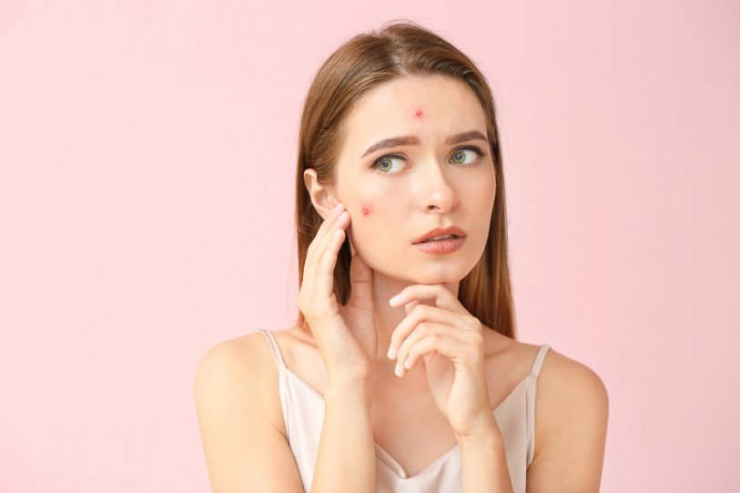 psoriasis medicine ayurvedic psoriasis medicine ayurvedic