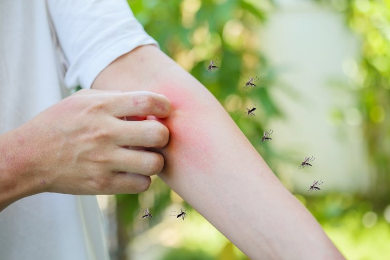 urticaria treatment in ayurveda