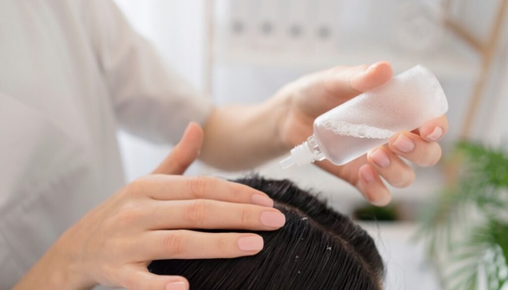 ayurvedic dandruff treatment