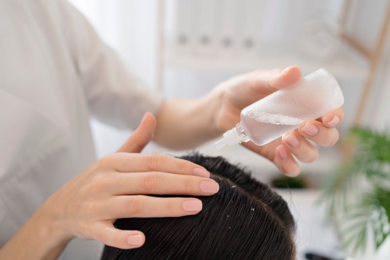 ayurvedic dandruff treatment