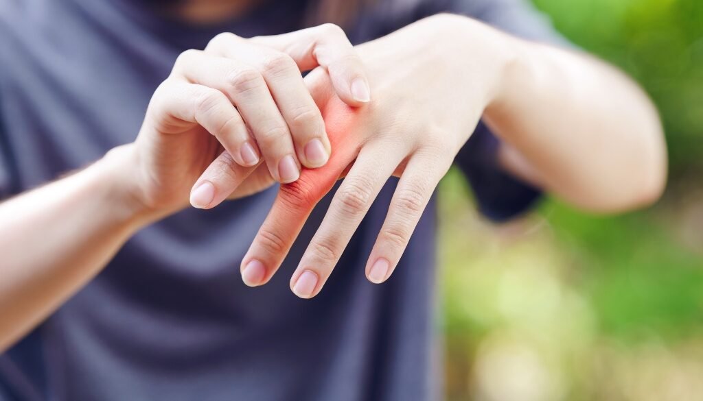 Ayurvedic treatment for Rheumatoid Arthritis in Dubai